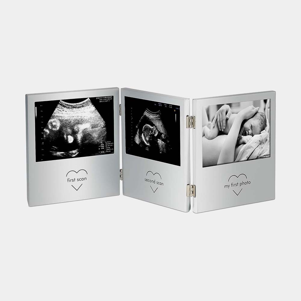 Baby Scan Photo Frame